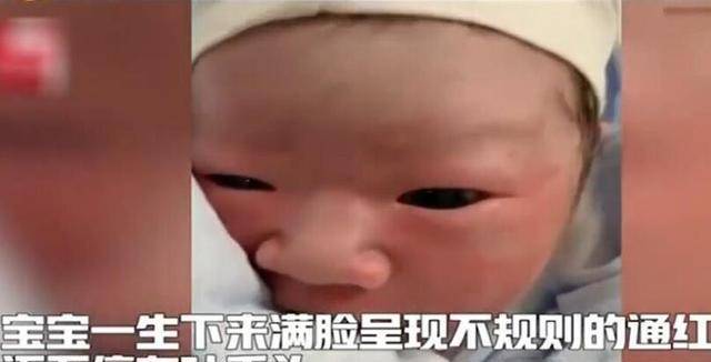 两个月宝宝总是吐舌头，探索新生儿行为背后的奥秘