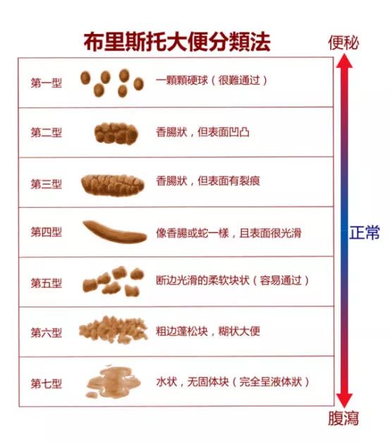 新生儿大便成型的时间及其影响因素探讨